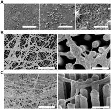 Científicos del Hospital Nacional de Parapléjicos arrojan luz sobre las posibilidades de la nanotecnología con electrodos de oro en el crecimiento de redes neurales